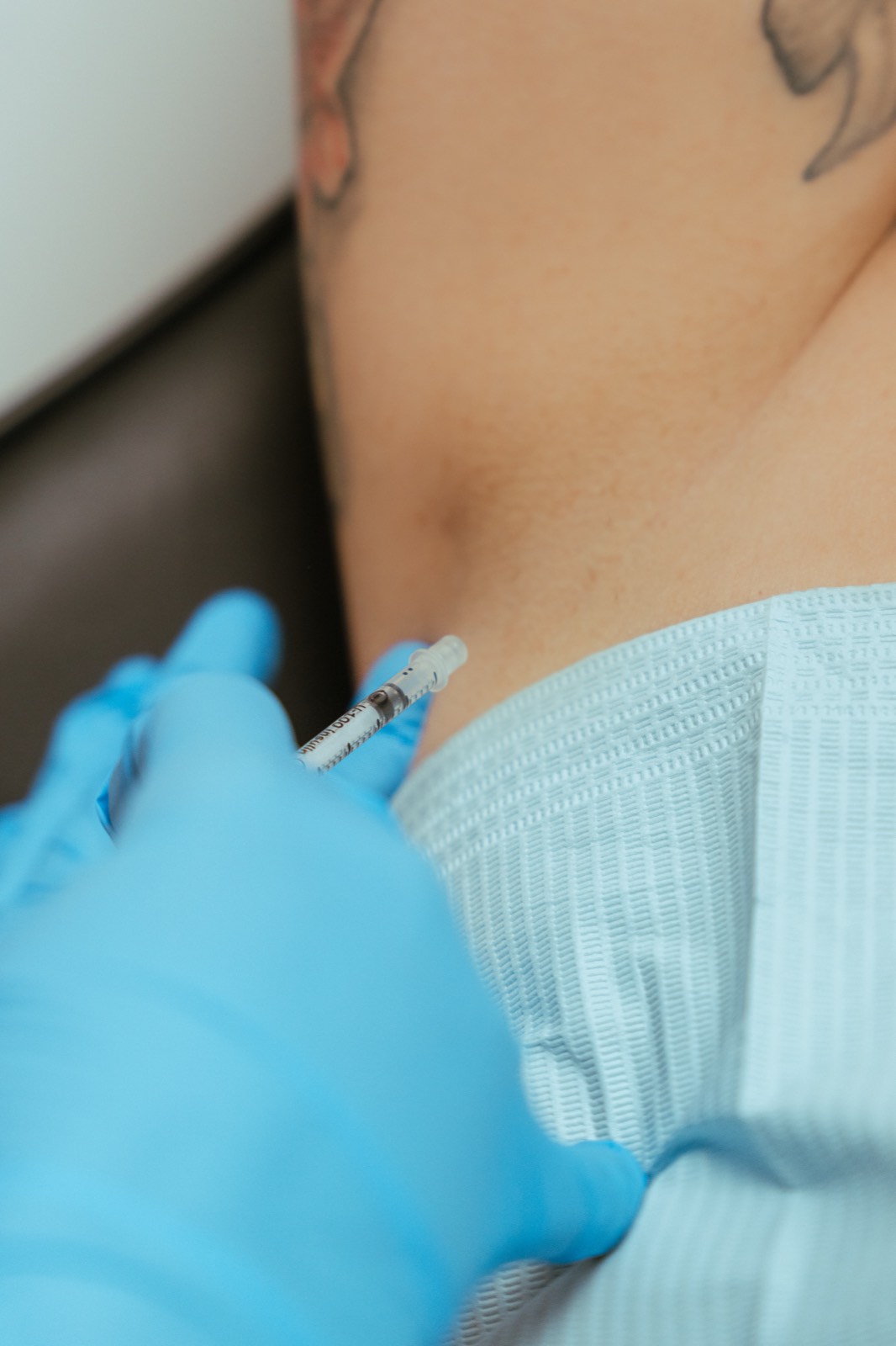 Botox médical : bruxisme, hyperhidrose